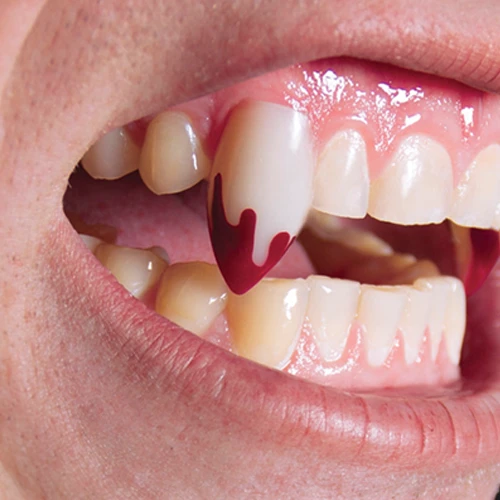 Scarecrow Blood Tip Deluxe Vampire Fangs | Vampiertanden 3 Scarecrow Blood Tip Deluxe Vampire Fangs | Vampiertanden - Afbeelding 3