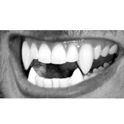 Scarecrow Werewolf Deluxe Fangs | Weerwolftanden -Halloween Cosmetica scarecrow werewolf deluxe fangs weerwolftandenf1240