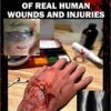 Special Effects Guide Of Real Human Wounds And Injuries